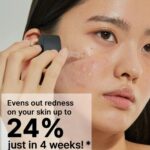 COSRX The Niacinamide 15 Serum 20ml - Image 4