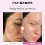 COSRX The Niacinamide 15 Serum 20ml - Image 5
