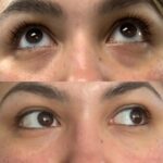 CLINIQUE All About Eyes 15ml - Image 3