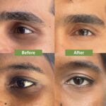 CLINIQUE All About Eyes Rich 15ml - Image 3