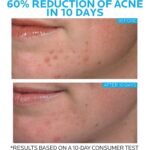 La Roche-Posay Effaclar Duo+M 40ml - Image 4