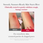 Medicube Red Acne Body Peeling Shot 110g - Image 6